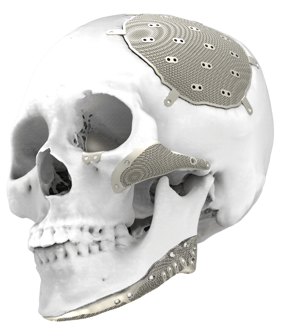 Skull bottom